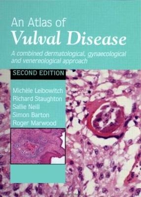 An Atlas of Vulval Diseases - Michèle Leibowitch, Richard Staughton, Sallie Neill, Simon Barton, Roger Marwood