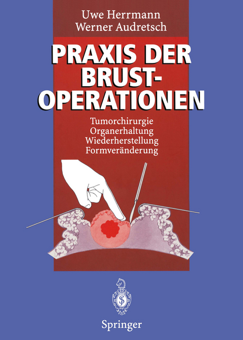 Praxis der Brustoperationen - Uwe Herrmann, Werner Audretsch