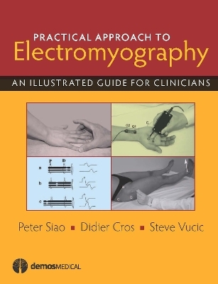 Practical Approach to Electromyography - Peter Siao, Didier Cros, Steve Vucic