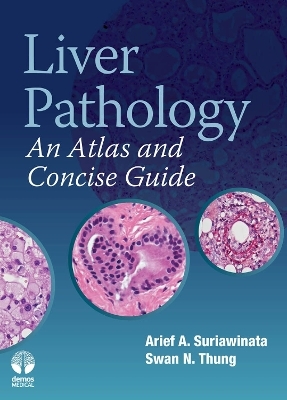 Liver Pathology - Arief Suriawinata, Swan Thung