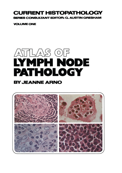 Atlas of Lymph Node Pathology - J. Arno