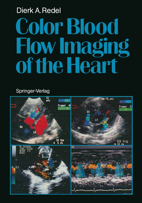 Color Blood Flow Imaging of the Heart - Dierk A. Redel