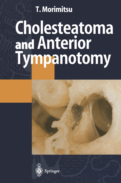 Cholesteatoma and Anterior Tympanotomy - Tamotsu Morimitsu