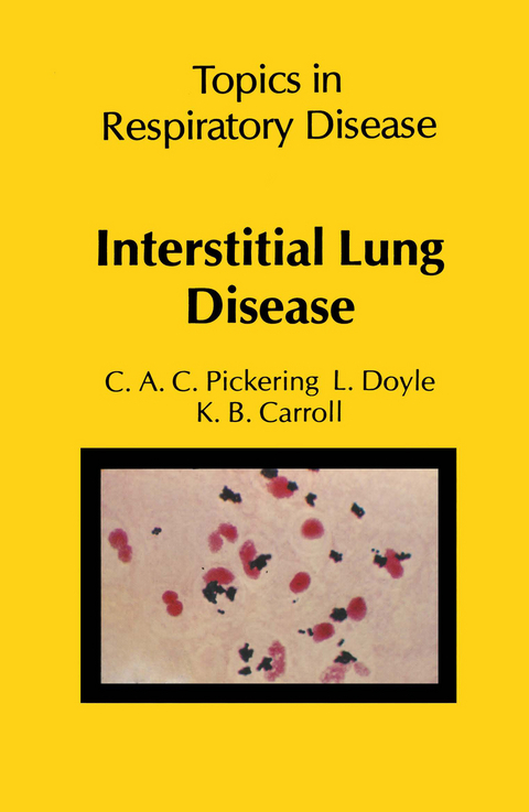 Interstitial Lung Disease - C.A.C. Pickering, L. Doyle, K.B. Carroll