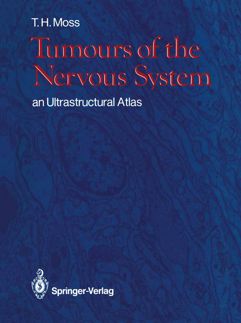 Tumours of the Nervous System - Timothy H. Moss