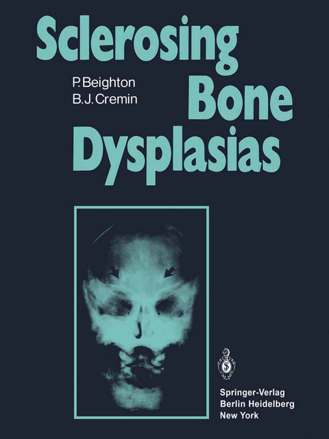 Sclerosing Bone Dysplasias - P. Beighton, B. J. Cremin