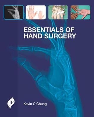 Essentials of Hand Surgery - 