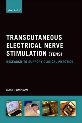 Transcutaneous Electrical Nerve Stimulation (TENS) - Mark I. Johnson