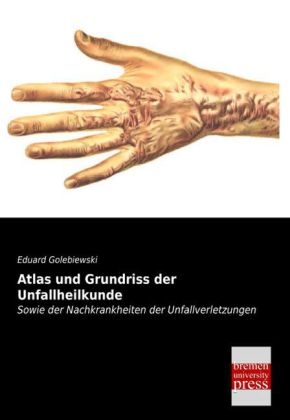Atlas und Grundriss der Unfallheilkunde - Eduard Golebiewski