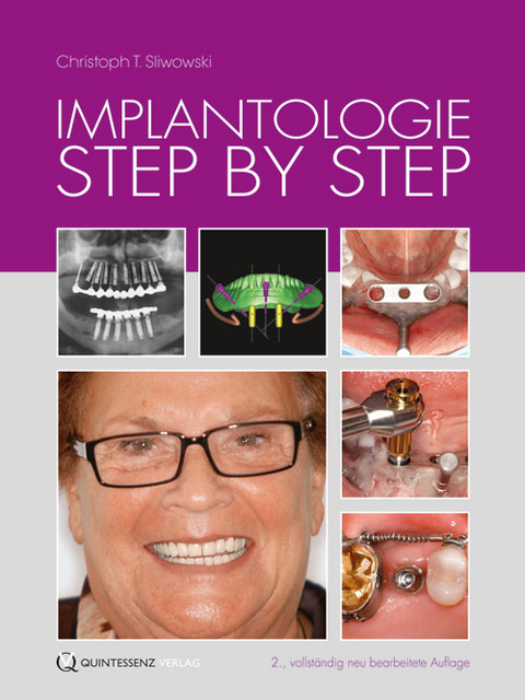 Implantologie Step by Step - Christoph T. Sliwowski