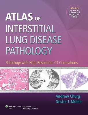 Atlas of Interstitial Lung Disease Pathology - Andrew Churg