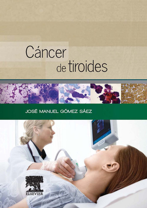 Cáncer de tiroides - 