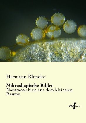 Mikroskopische Bilder - Hermann Klencke