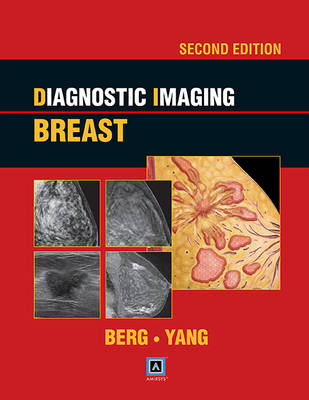Diagnostic Imaging: Breast, 2nd ed - Dr. Wendie A. Berg, Dr. Wei Tse Yang