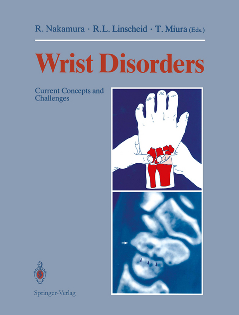 Wrist Disorders - 