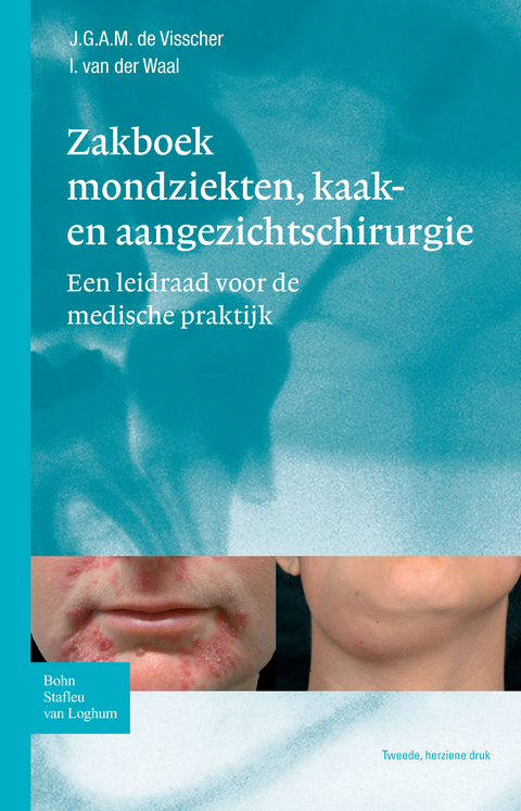 Zakboek mondziekten, kaak- en aangezichtschirurgie -  J.G.A.M. de Visscher,  I. van der Waal