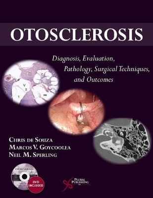 Otosclerosis - Chris De Souza, Marcos V. Goycoolea, Neil M. Sperling