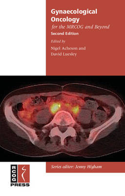 Gynaecological Oncology for the MRCOG and Beyond - 
