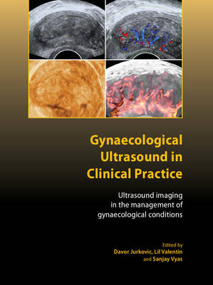 Gynaecological Ultrasound in Clinical Practice - 