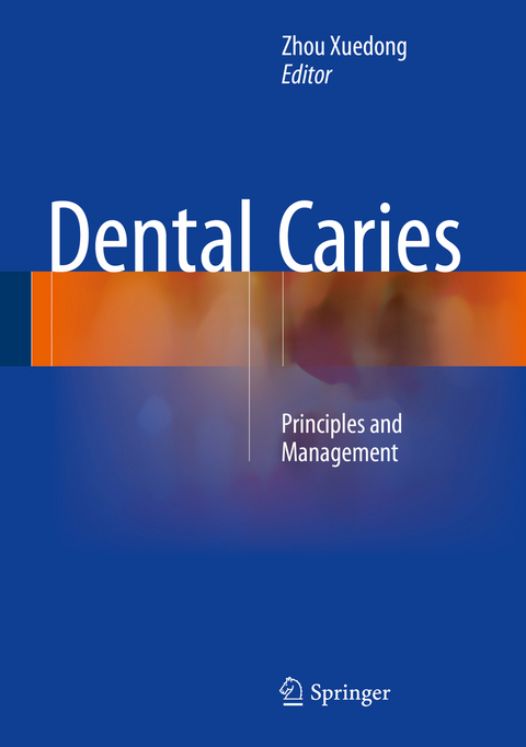 Dental Caries - 