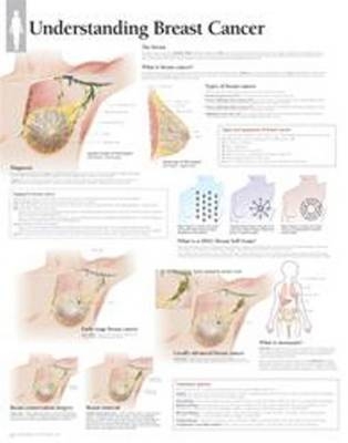 Understanding Breast Cancer Paper Poster -  Scientific Publishing