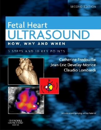 Fetal Heart Ultrasound - Catherine Fredouille, Jean-Eric Develay-Morice, Claudio Lombardi