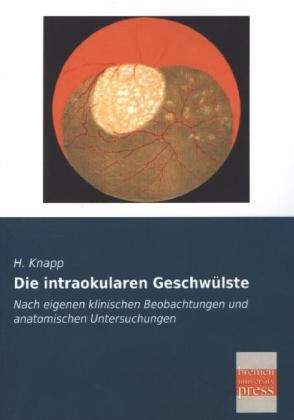 Die intraokularen Geschwülste - H. Knapp