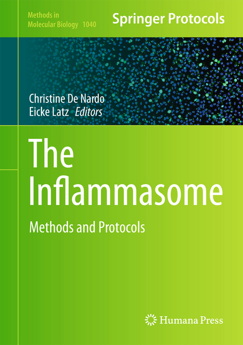 The Inflammasome - 