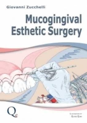 Mucogingival Esthetic Surgery - Giovanni Zucchelli