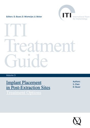 Implant Placement in Post-Extraction Sites - Stephen Chen, Daniel Buser