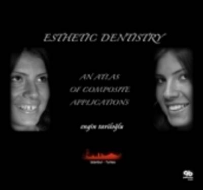 Esthetic Dentistry - Engin Taviloglu