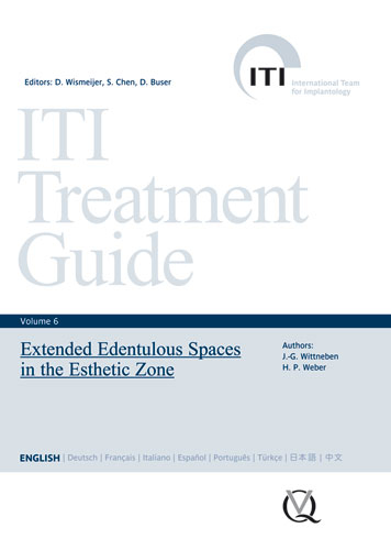 Extended Edentulous Spaces in the Esthetic Zone - Julia-Gabriela Wittneben Matter, Hans-Peter Weber