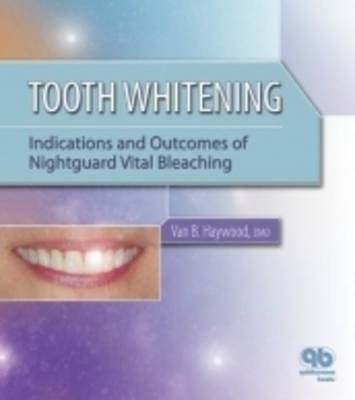 Tooth Whitening - Van B. Haywood