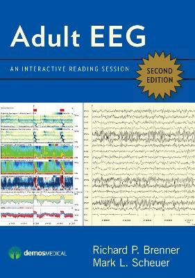 Adult EEG - Richard P. Brenner, Mark L. Scheuer