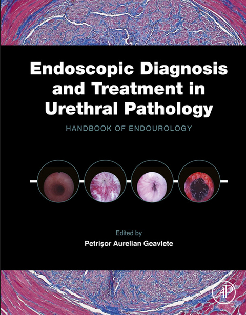 Endoscopic Diagnosis and Treatment in Urethral Pathology - 