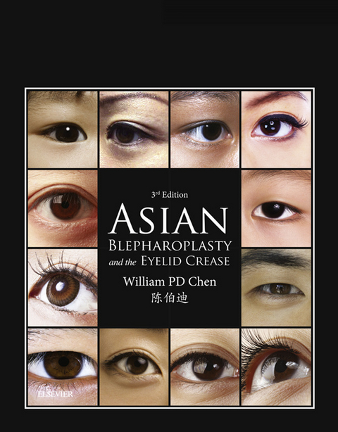 Asian Blepharoplasty and the Eyelid Crease -  William P. Chen