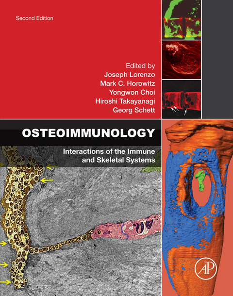 Osteoimmunology - 