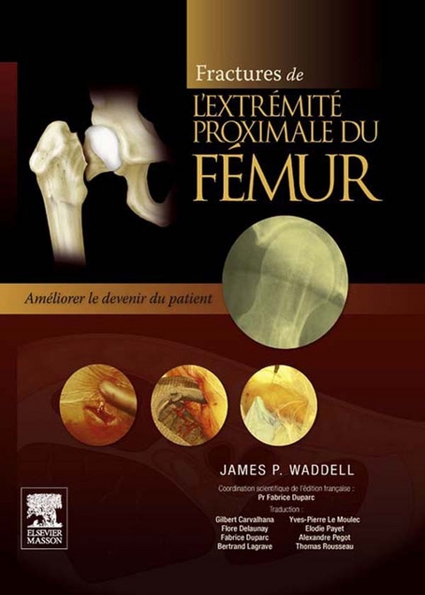 Fractures de l''extrémité proximale du fémur -  Fabrice Duparc,  James P. Waddell