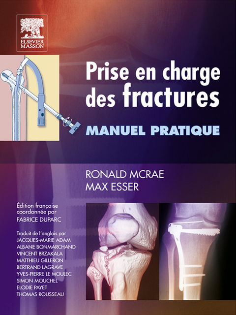 Prise en charge des fractures -  John Scott &  Co,  Fabrice Duparc,  Max Esser,  Ronald McRae