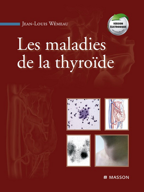 Les maladies de la thyroïde -  Jean-Louis Wemeau
