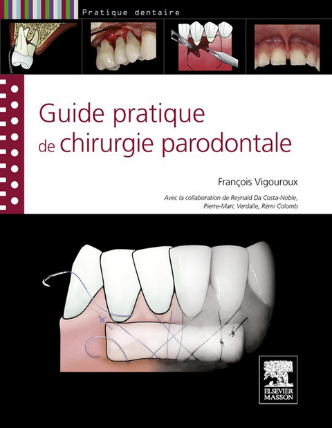 Guide pratique de chirurgie parodontale -  Francois Vigouroux