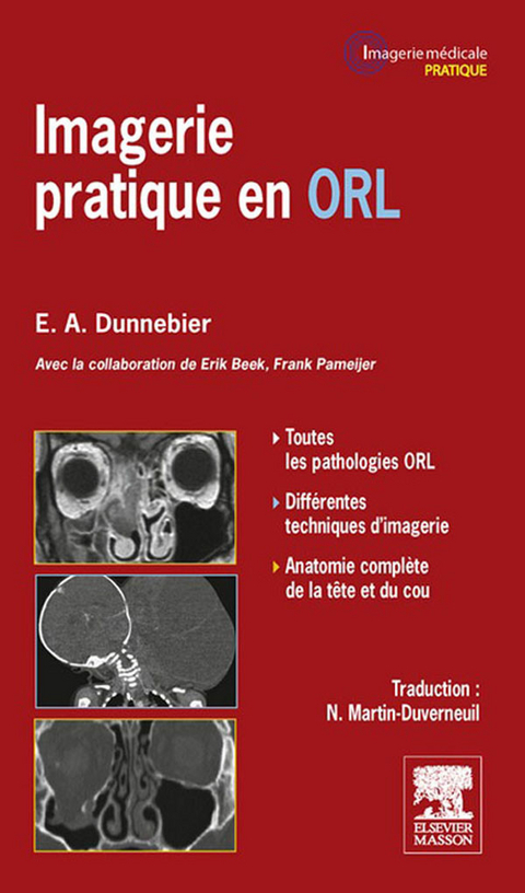 Imagerie pratique en ORL -  Erik Beek,  Erwin A Dunnebier,  Nadine Martin-Duverneuil,  Frank Pameijer