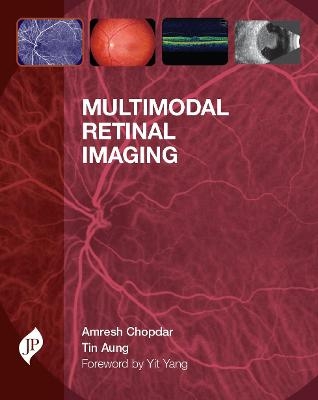 Multimodal Retinal Imaging - Amresh Chopdar, Tin Aung