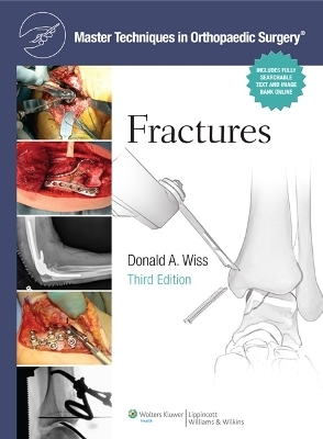 Master Techniques in Orthopaedic Surgery: Fractures - Donald Wiss