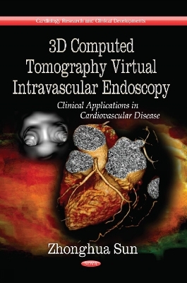 3D Computed Tomography Virtual Intravascular Endoscopy - Zhonghua Sun