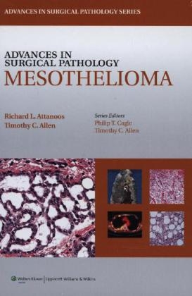 Advances in Surgical Pathology: Mesothelioma - Richard L Attanoos, Timothy C. Allen