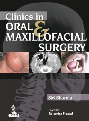 Clinics in Oral & Maxillofacial Surgery - SM Sharma