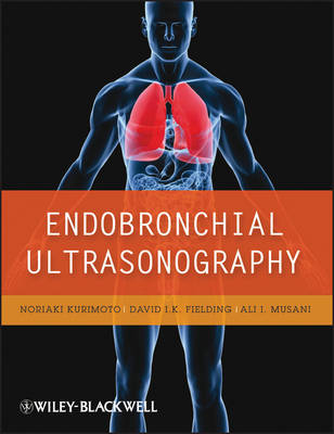 Endobronchial Ultrasonography - N Kurimoto