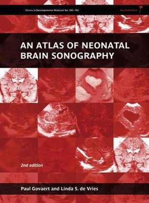 Atlas of Neonatal Brain Sonography, 2nd Edition -  Linda S de Vries,  Paul Govaert