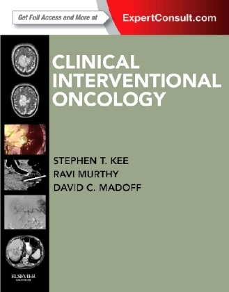 Clinical Interventional Oncology - Stephen T Kee, David C Madoff, Ravi Murthy